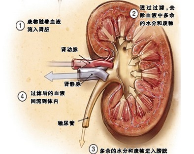 肾病综合征引起原因怎么食疗苗药大健康养生